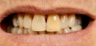 bna-sample